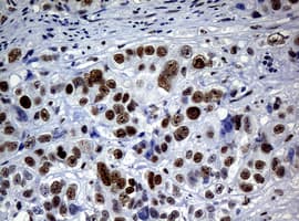NBN / Nibrin Antibody (aa461-754, clone OTI1G10, Carrier-free)