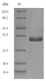 Escherichia coli genomic DNA. (21.3-21.7 min) Protein (Recombinant 6His-SUMO, N-terminus)
