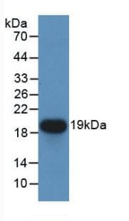 CDNF / ARMETL1 Antibody