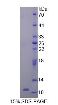 Human HOPX / HOP Protein (Recombinant His-T7)