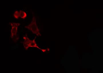Polyclonal Rabbit anti-Human PPM1L Antibody (IF, WB)