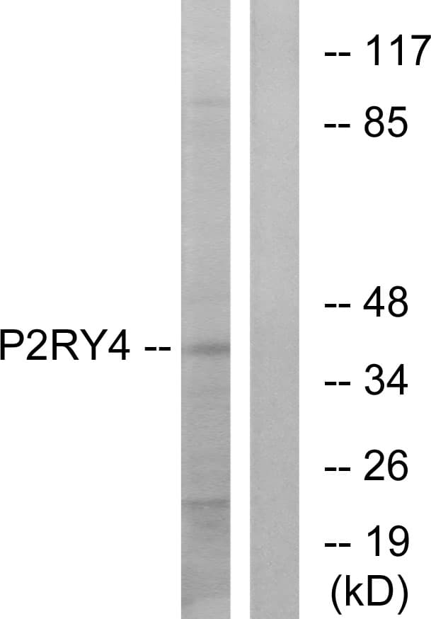 P2RY4 / P2Y4 Antibody (aa159-208)