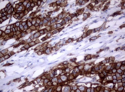 ERBB2 / HER2 Antibody (aa676-1255, clone UMAB34)