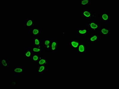 Polyclonal Rabbit anti-Human HIST1H2AI Antibody (IHC, IF, WB)