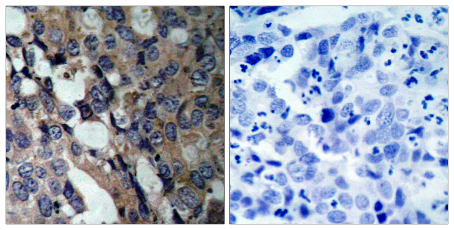 Polyclonal Rabbit anti-Human HSPB1 / HSP27 Antibody (aa5-54, IHC, WB)