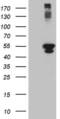 PSMD5 Antibody (aa2-140, clone OTI8B1)