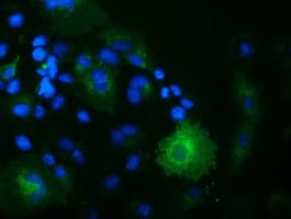 OSBPL11 Antibody (clone OTI6H9)