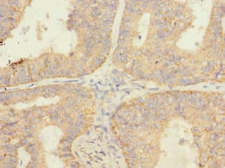 SAV1 / WW45 Antibody