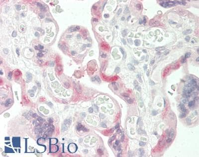 IHC-plus™ TGM2 / Transglutaminase 2 Antibody (aa667-680)