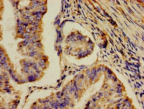 AOC3 / VAP-1 Antibody