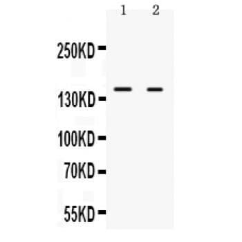 NRIP1 / RIP140 Antibody (aa273-306)
