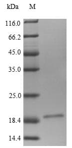 Human LRP4 Protein (Recombinant 6His, N-terminus)