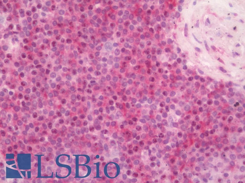 IHC-plus™ FZD5 / Frizzled 5 Antibody (aa31-80)