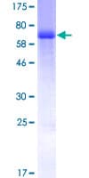 Human RCN2 Protein (Recombinant GST)