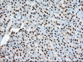 ERIC-1 / TACC3 Antibody (clone OTI6F1, Carrier-free)