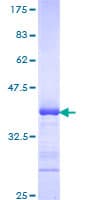 Human ADAM2 / Fertilin Beta Protein (Recombinant GST, N-terminus)