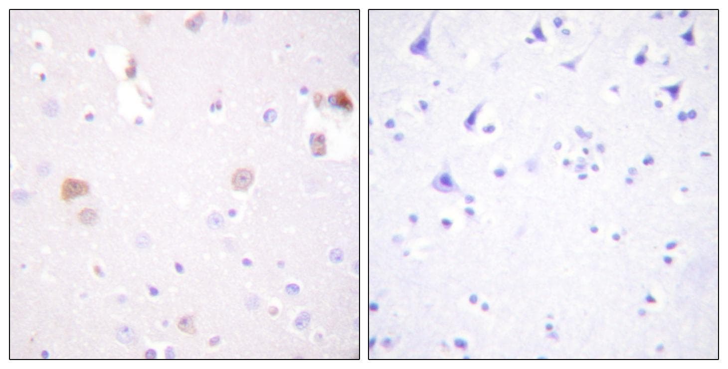 Polyclonal Rabbit anti-Human PLD1 / Phospholipase D1 Antibody (IHC)
