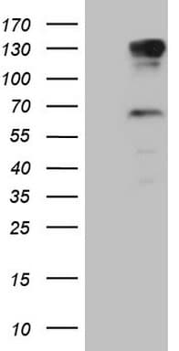PARG Antibody (aa1-367, clone OTI1B5)