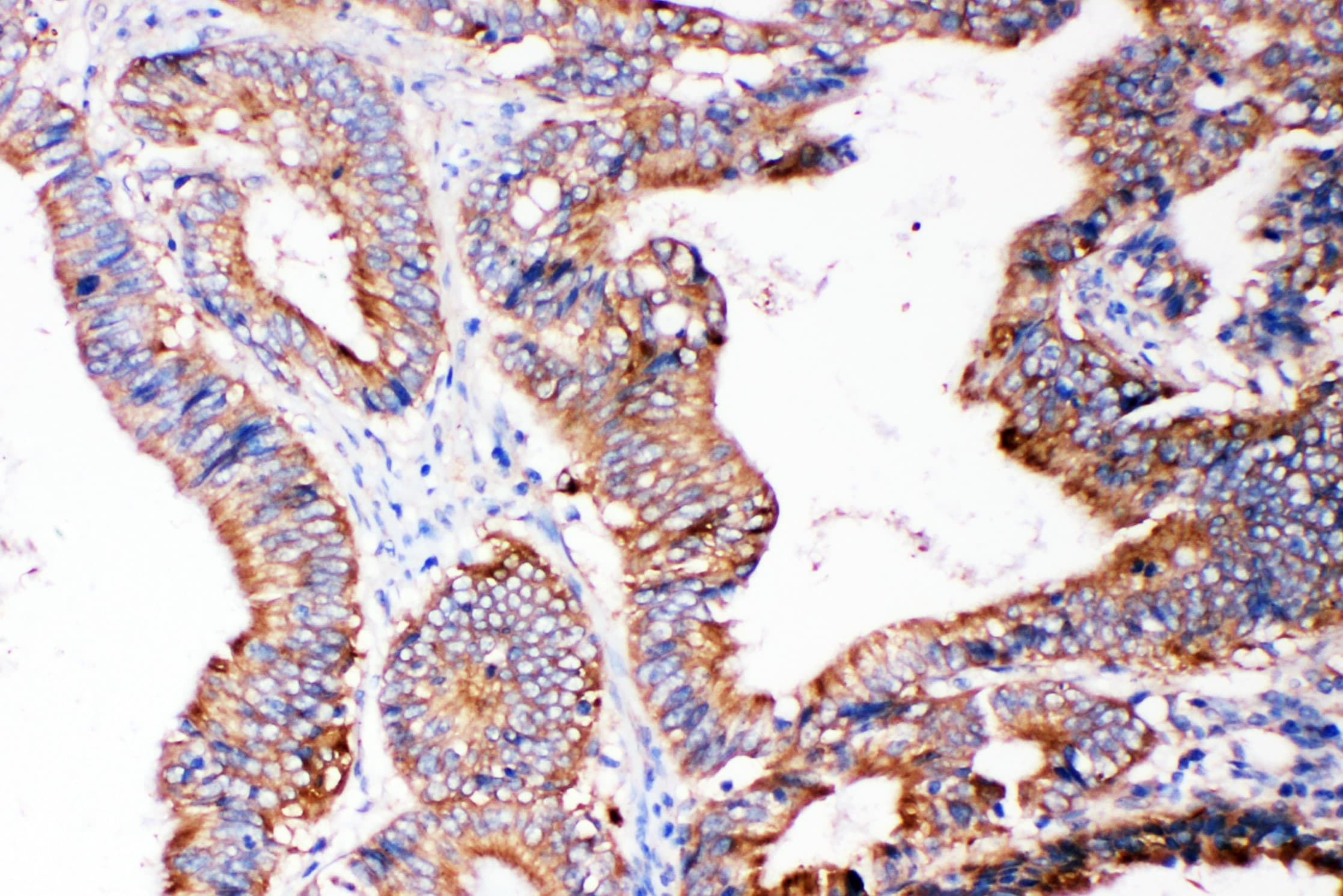 SMAD5 Antibody (aa248-267)