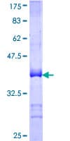 Human BCL11A Protein (Recombinant GST, N-terminus)