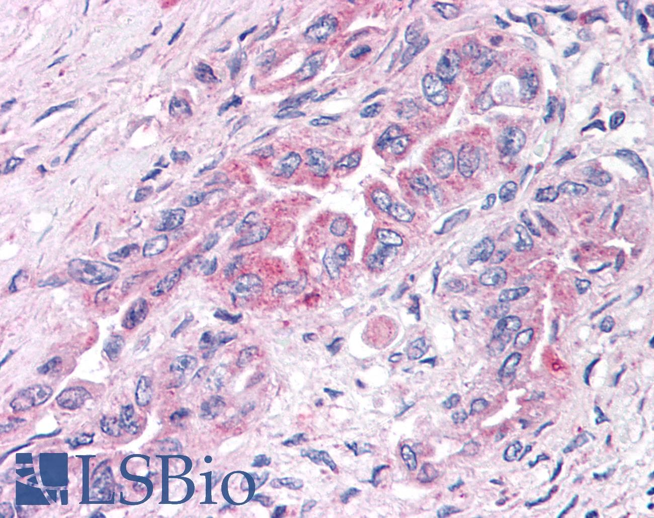 PathPlus™ GPER1 / GPR30 Antibody (N-Terminus)