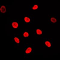 AK6 / Adenylate Kinase 6 Antibody (N-Terminus)
