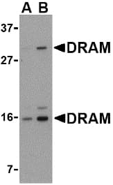 IHC-plus™ DRAM1 / DRAM Antibody