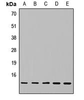 NDUFA5 Antibody