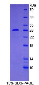 Human BCL2 / Bcl-2 Protein (Recombinant His-T7)