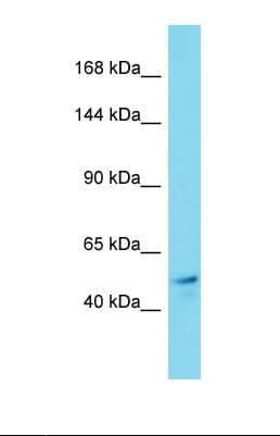 Polyclonal Rabbit anti-Human KIF19 Antibody (N-Terminus, WB)