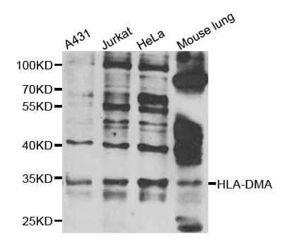 Polyclonal Rabbit anti-Human HLA-DMA Antibody (WB)