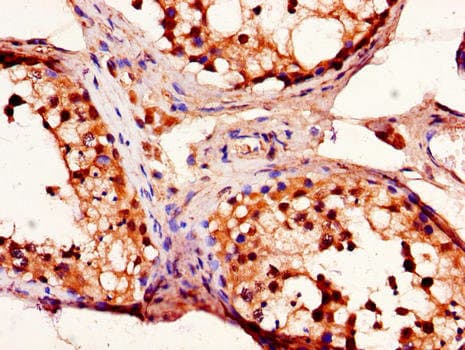 Fibulin-3 / EFEMP1 Antibody
