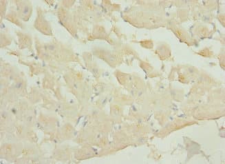 PIP5K1A Antibody