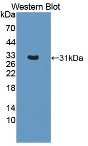 HLA-DRB1 Antibody (aa27-264)
