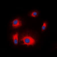 Polyclonal Rabbit anti-Human RPS6KB1 / P70S6K / S6K Antibody (Internal, IHC, IF, WB)