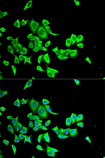 Polyclonal Rabbit anti-Human SERPINB1 Antibody (IHC, IF, WB)