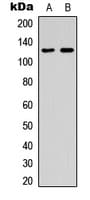 HTS1 / ST5 Antibody (Internal)
