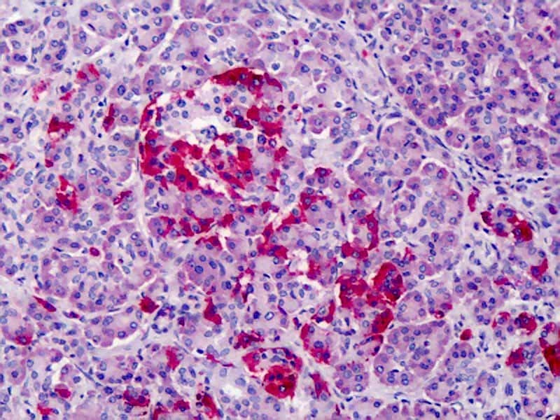 IHC-plus™ Polyclonal Rabbit anti-Human GPR3 Antibody (IHC, IF, WB)