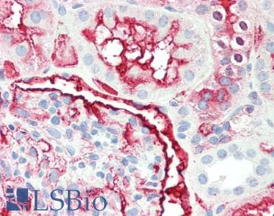 IHC-plus™ Alkaline Phosphatase Antibody (clone BGN/03/661)