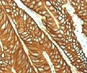 EPCAM Antibody (clone EPM17-1)