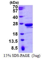 Human MOG1 / RANGRF Protein (Recombinant His)
