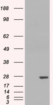 IHC-plus™ GSTP1 / GST Pi Antibody (aa22-33)