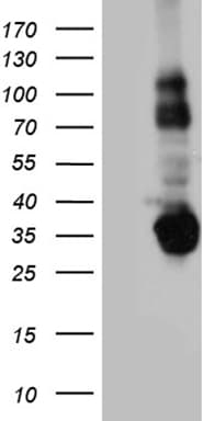 Monoclonal Mouse anti-Human STX3 / Syntaxin 3 Antibody (clone OTI5B12, WB)