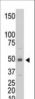 CKM / Creatine Kinase MM Antibody (aa283-313)