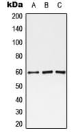 MAOA / Monoamine Oxidase Antibody (Internal)
