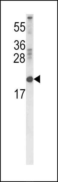Polyclonal Rabbit anti-Human RBP2 / CRBPII Antibody (aa56-84, WB)