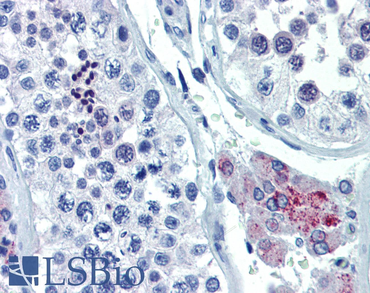 Polyclonal Rabbit anti-Human ASH2L / ASH2 Antibody (aa288-337, IHC, WB)