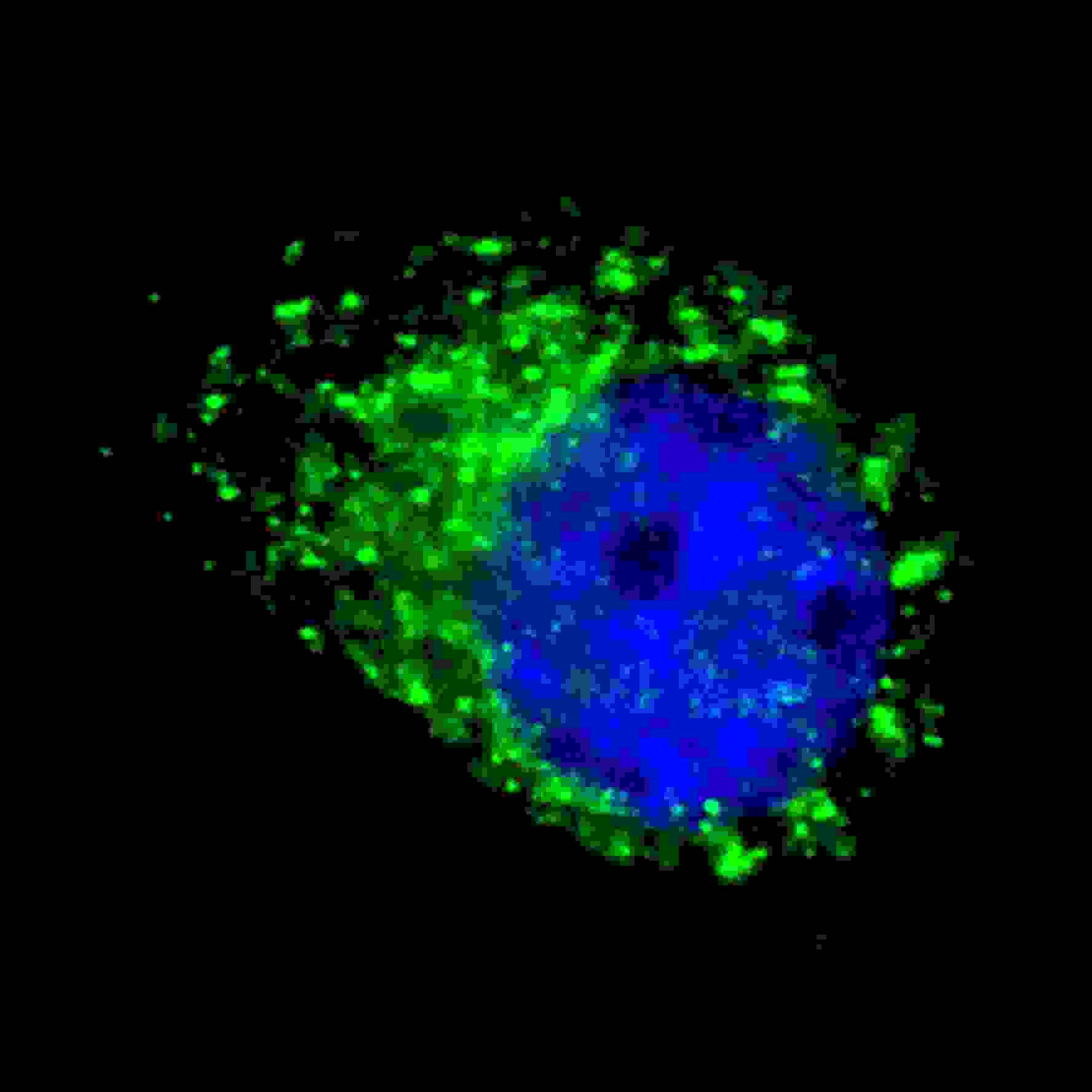 IHC-plus™ Polyclonal Rabbit anti-Human MAP1LC3B / LC3B Antibody (aa100-125, IHC, IF, WB)