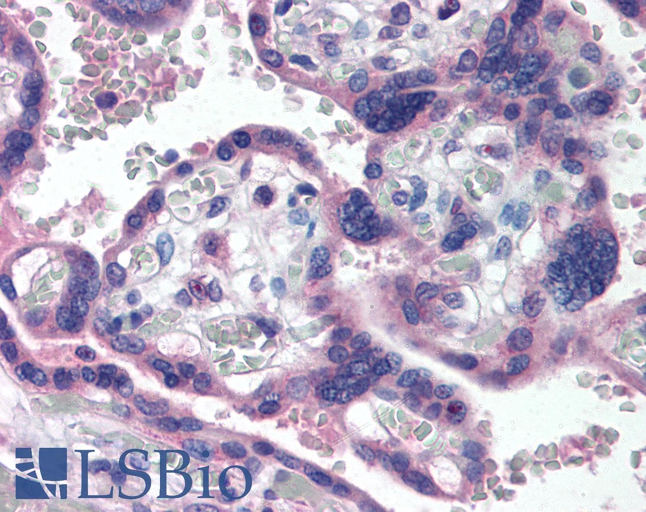 IHC-plus™ TP73 / p73 Antibody (aa2-13, clone 38C674.2)