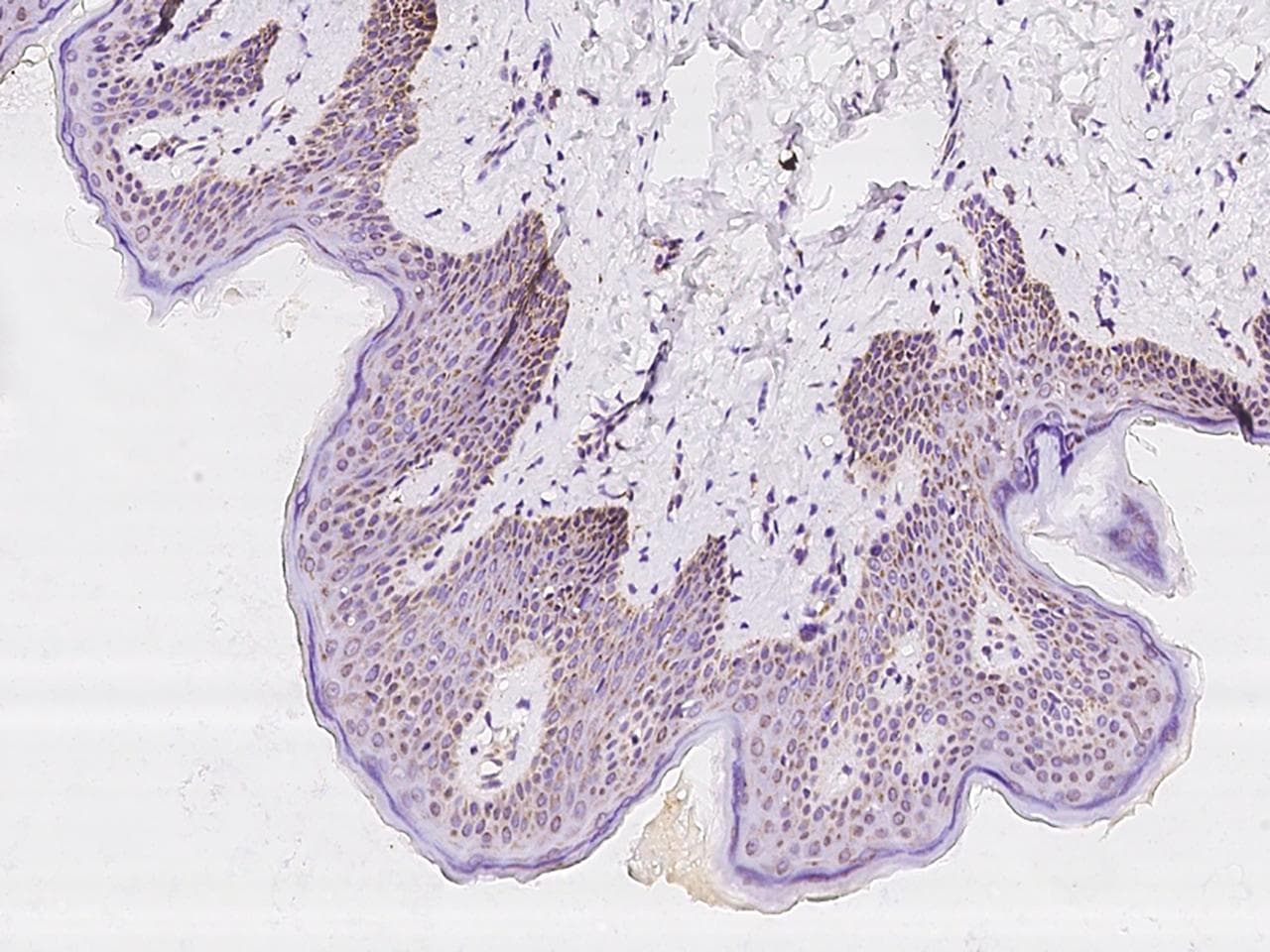 Polyclonal Rabbit anti-Human MT-CO3 / COX3 / COXIII Antibody (IHC, IF)